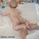 перевіряємо рефлекси