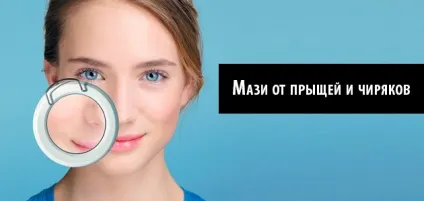 Протизапальні мазі список препаратів від запалення для суглобів, очей, шкіри, спини і прищів (препаратів) Протизапальні мазі список препаратів від запалення для суглобів, очей, шкіри, спини і прищів
