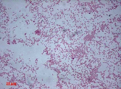 Протей мірабіліс (proteus mirabilis)