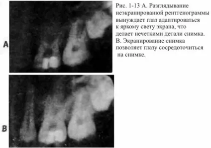 розшифровка рентгенограм