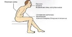 стадії ХСН