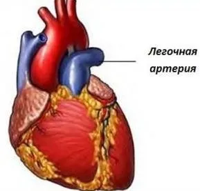 Стеноз легеневої артерії причини, симптоми, лікування і профілактика