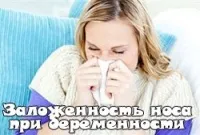 Симптоми і лікування ринофарингіту (заливаємо склянкою окропу залишаємо) Симптоми і лікування ринофарингіту