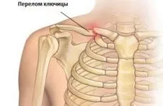 Симптоми, наслідки та лікування перелому куприка (наслідки) Симптоми, наслідки та лікування перелому куприка