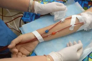 Синдром тривалого здавлення - клінічна картина, перша допомога та лікування (синдром тривалого здавлення перша допомога) Синдром тривалого здавлення - клінічна картина, перша допомога та лікування