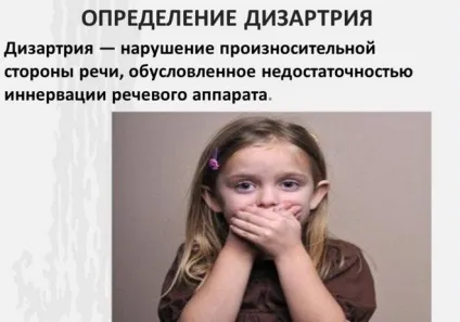 Шкала оцінки тяжкості інсульту nihss як її правильно застосовувати (тяжкості) Шкала оцінки тяжкості інсульту nihss як її правильно застосовувати