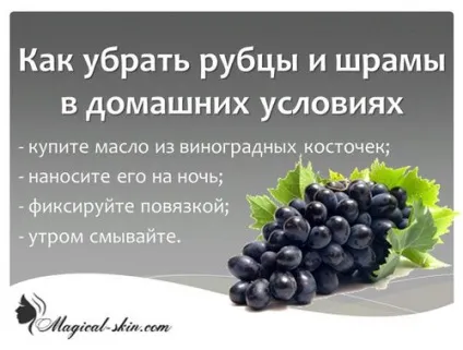 Шрам на плечі від якої щеплення (який) Шрам на плечі від якої щеплення