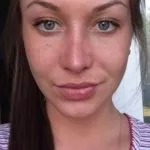Скільки тримається набряк носа після ринопластики фото і відгуки