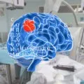 Субепендімальная кіста у новонародженої дитини, її ознаки, лікування, наслідки (субепендімальная) Субепендімальная кіста у новонародженої дитини, її ознаки, лікування, наслідки