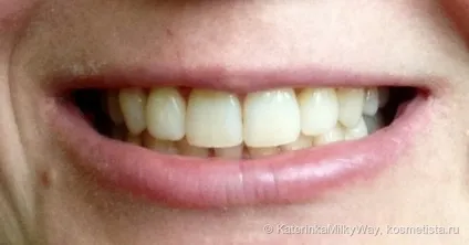 Стоматологічний мус для зубів gc tooth mousse - кращий друг для красивих зубів і посмішки відгуки (мус) Стоматологічний мус для зубів gc tooth mousse - кращий друг для красивих зубів і посмішки відгуки