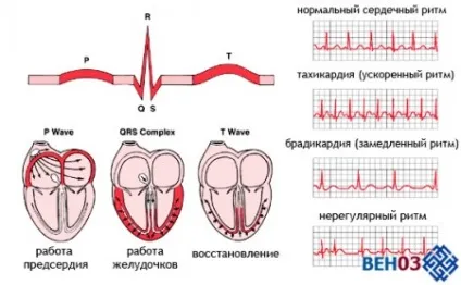 Тахікардія серця що це таке, стенокардія, брадикардія (симптоми) (тахікардія стенокардія симптоми лікування що це таке синусова пароксизмальна домашніх умовах) Тахікардія серця що це таке, стенокардія, брадикардія (симптоми)