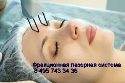 Тонка шкіра обличчя і особливості догляду за нею пілінг, рецепти масок, косметологія (лазерне шліфування) Тонка шкіра обличчя і особливості догляду за нею пілінг, рецепти масок, косметологія