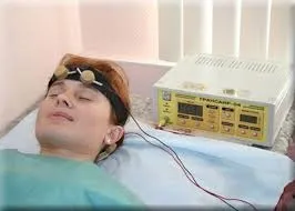 Транскраниальная мікрополярізаціі (головного мозку ТКМП) транскраниальная мікрополярізаціі