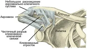 Травми в хокеї з шайбою (шайбою) Травми в хокеї з шайбою