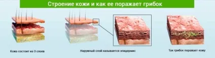 Ванночки від грибка стопи в домашніх умовах (грибка) Ванночки від грибка стопи в домашніх умовах