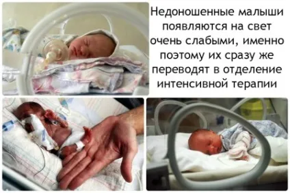 Догляд за недоношеною дитиною (як доглядати за недоношеною дитиною) Догляд за недоношеною дитиною