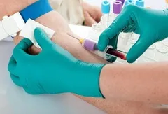ВІЛ інфекція та СНІД в чому різниця