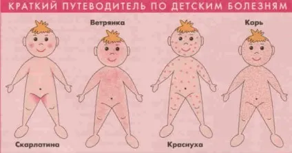 Вірусний дерматит у дітей причини, симптоми, лікування, профілактика