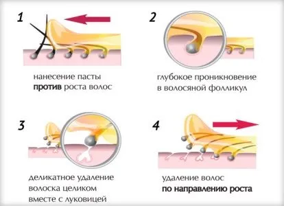 Воскова епіляція особи вся процедура, рекомендації (рекомендації) Воскова епіляція особи вся процедура, рекомендації