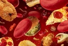 Холестіріновие камені в жовчному міхурі лікування (холестеринові камені в жовчному міхурі) Холестіріновие камені в жовчному міхурі лікування