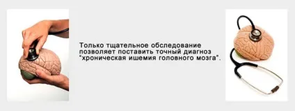 Хронічна ішемія головного мозку що це таке, симптоми і лікування (головного) Хронічна ішемія головного мозку що це таке, симптоми і лікування