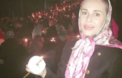 Юлія Міхалкова фото до і після операції - 300 (після) Юлія Міхалкова фото до і після операції - 300