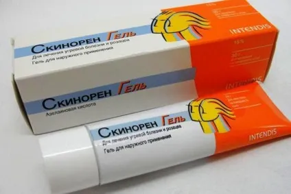 За які органи відповідають прищі на обличчі, як їх лікувати