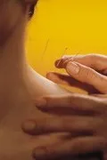 Защемлення променевого нерва - легка втрата рухових функцій (защемлення променевого нерва) Защемлення променевого нерва - легка втрата рухових функцій