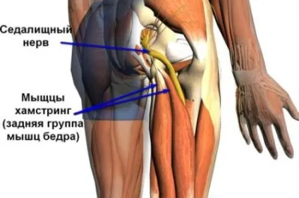 Защемлення нерва в тазостегновому суглобі (стегні) симптоми і лікування (нерва) Защемлення нерва в тазостегновому суглобі (стегні) симптоми і лікування