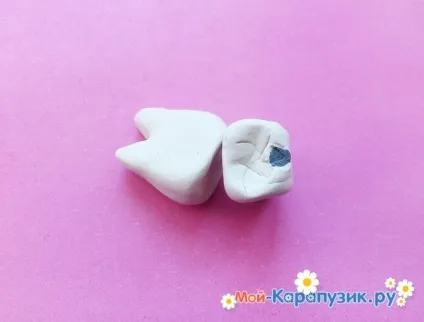 Зуб з пластиліну 1