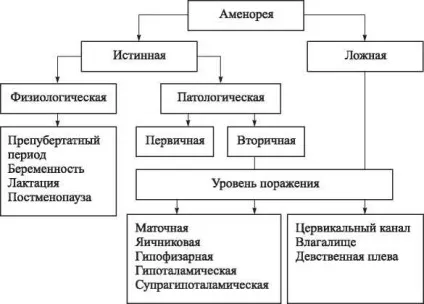 Аменорея форми і причини виникнення, симптоми і методи лікування (форми) Аменорея форми і причини виникнення, симптоми і методи лікування