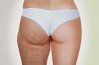 Body beauty clinic - апаратна корекція фігури (clinic) Body beauty clinic - апаратна корекція фігури