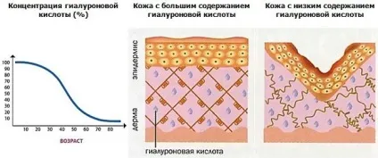 Біоревіталізація для шкіри обличчя переваги (Гіалуронова кислота є) Біоревіталізація для шкіри обличчя переваги