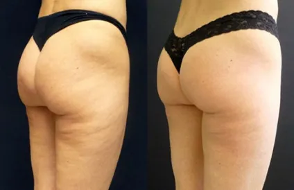 Body beauty clinic - апаратна корекція фігури (beauty) Body beauty clinic - апаратна корекція фігури