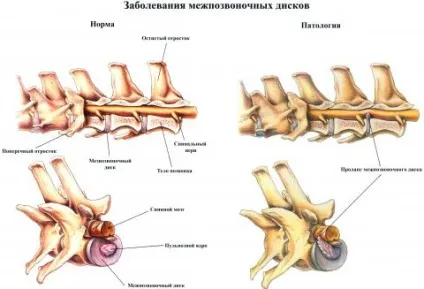 Хвороба міжхребцевих дисків собак (пам'ятка для власників), ветеринарна клініка доктора Шубіна (собак) Хвороба міжхребцевих дисків собак (пам'ятка для власників), ветеринарна клініка доктора Шубіна