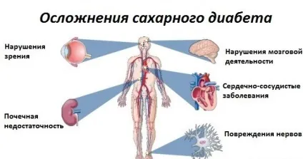 Чим небезпечний цукровий діабет 2 типу, наслідки у жінок і чоловіків (типу) Чим небезпечний цукровий діабет 2 типу, наслідки у жінок і чоловіків