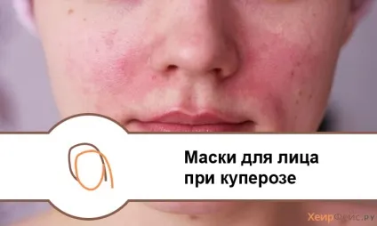 Домашні маски при купероз на обличчі рецепти