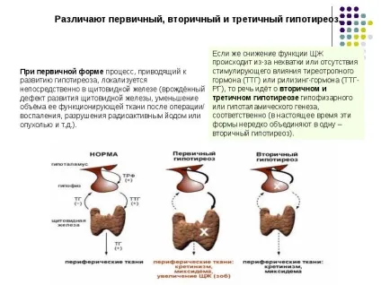 Доповідь по темі щитовидна залоза (powerpoint) Доповідь по темі щитовидна залоза