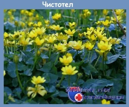 Ефективні народні методи лікування гострих кондилом