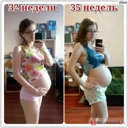 Природні пологи - «як це - народжувати дві доби пологи з короткозорістю (діб) Природні пологи - «як це - народжувати дві доби пологи з короткозорістю