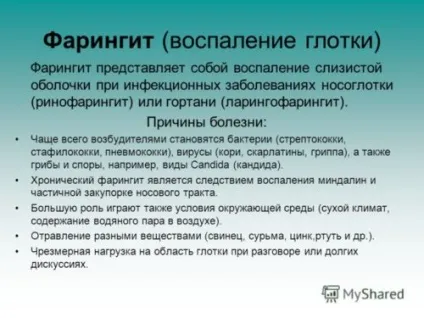 Фарингіт причини, симптоми, діагностика та лікування