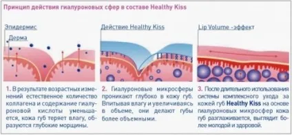 Гіалуронова кислота в боротьбі зі зморшками ризики і протипоказання (кислота) Гіалуронова кислота в боротьбі зі зморшками ризики і протипоказання
