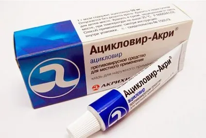 Герпес на лобі як лікувати (герпес) Герпес на лобі як лікувати
