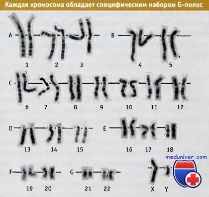 G-смуги хромосом і їх значення (G-смуги хромосом значення) G-смуги хромосом і їх значення