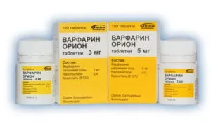Відкрите овальне вікно у новонародженого що це (овальне вікно новонародженого) Відкрите овальне вікно у новонародженого що це