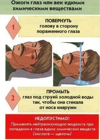 Опік рогівки ока - чим лікувати (опік рогівки ока зварюванням хімічний опік) Опік рогівки ока - чим лікувати