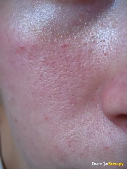 Відгук про тональний крем l - oreal mat - magique - магія матової шкіри далеко не ідеальний, а так (тональний) Відгук про тональний крем l - oreal mat - magique - магія матової шкіри далеко не ідеальний, а так
