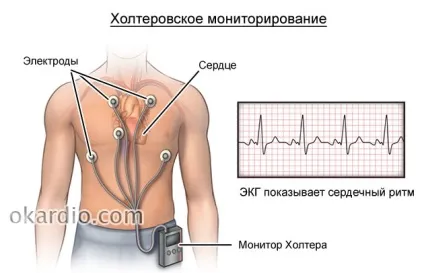Каг (коронарна ангіографія) показання, як проводять, ніж корисно дослідження (коронарна) Каг (коронарна ангіографія) показання, як проводять, ніж корисно дослідження