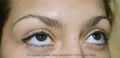 Як виправити невдалий татуаж брів, повік (як виправити невдалий татуаж брів) Як виправити невдалий татуаж брів, повік