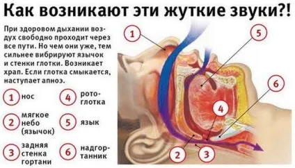 Як позбавитися від хропіння народні і радикальні методи (позбутися) Як позбавитися від хропіння народні і радикальні методи